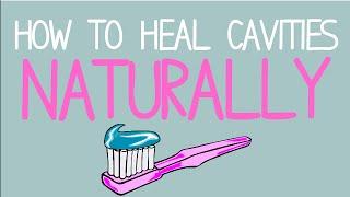 How to Heal Cavities NATURALLY