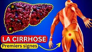 12 signes précoces de CIRRHOSE DU FOIE | Le foie est en train de mourir !