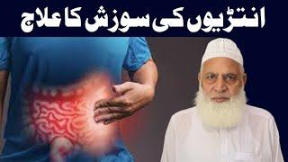 Anton Ki Sozish Ka | Anton Ki Khushki | Aanto Ki Sujan | Intestine Infection Ka ilaj Dr M Arshad