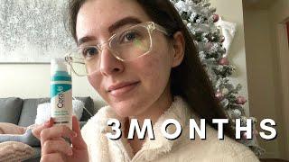 I Used Cerave Retinol for 3 Months | Photos + Update
