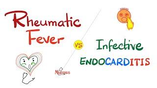 Rheumatic Fever vs. Infective Endocarditis - Comparison - Cardiology Series