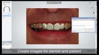 Dental System 2013 - RealView Engine™ with 2D Image Overlay