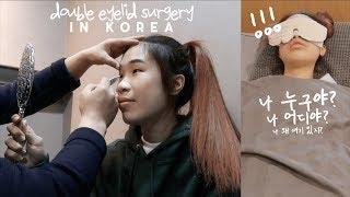 Double Eyelid Surgery in KOREA 저 쌍수했어요! Consultation, After Surgery VLOG (Full Incisional)