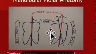 Oral Surgery Hints - Impaction Extraction