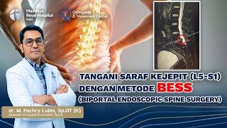 Penanganan Saraf Kejepit L5-S1 Dengan Metode BESS | dr. Fachry Lubis, Sp.OT (K) Spine