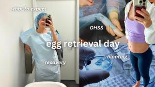 IVF EGG RETRIEVAL DAY | what to expect, extreme bloating, OHSS, recovery time, do's & dont's!