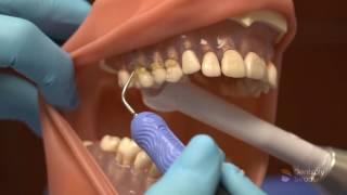 Cavitron FSI 10 | Dentsply Sirona