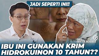 IBU INI GUNAKAN KRIM HIDROKUINON 10 TAHUN!? JADI SEPERTI INI! | TANYA DOKTER RICHARD