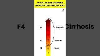 What is the danger range for FibroScan | Fibroscan | Liver Fibrosis Treatment  #viral #hepatitis