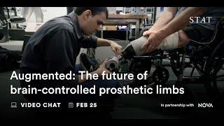 Virtual Event – ‘Augmented’: The future of brain-controlled prosthetic limbs