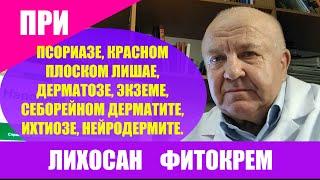 Лихосан фитокрем. При псориазе волосяной части головы. Красный плоский лишай. Себорейный дерматит.