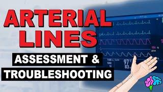 The Arterial Line Assessment & Troubleshooting!