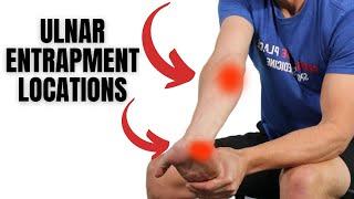 Ulnar Nerve Entrapment Treatment - How To Treat Pinky & Ring Finger Numbness