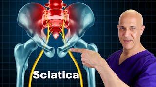 Relieve Sciatica, Low Back Pain & PInched Nerve | Dr. Mandell