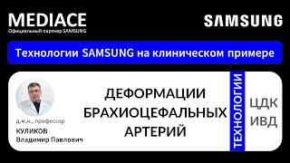 Деформации брахиоцефальных артерий (БЦА). Протокол УЗИ на клиническом примере