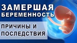 Как распознать замершую беременность? Что делать если замершая беременность. Причины замершей.