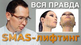 SMAS-лифтинг ВСЯ ПРАВДА #smasлифтинг