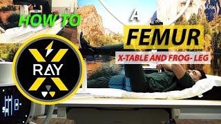 HOW TO X-RAY a FEMUR | routine | trauma | frog leg | cross table | danelius miller | rad tech