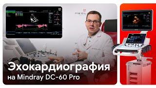 Эхокардиография (ЭхоКГ) на Mindray DC-60 Pro