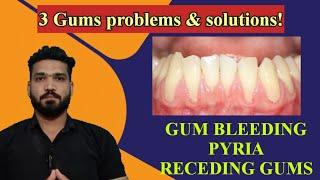 3 gums problems and solution at home & clinic