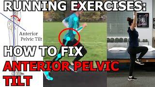 Running Exercises:  How to fix Anterior Pelvic Tilt to RUN FASTER!