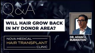 Does hair grow back at donor area after Hair Transplant?