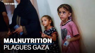 UN: 495,000 Gazans experiencing catastrophic food shortage