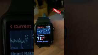 Lowest heart rate ever recorded | close to world record