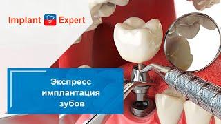 Экспресс имплантация зубов