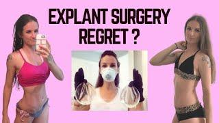 Explant Surgery Regrets? What You Need to Hear Before You Explant! | Breast Implant Illness Recovery