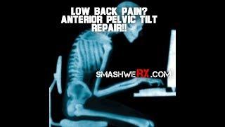 Anterior Pelvic Tilt and Low Back Pain | Trevor Bachmeyer | SmashweRx