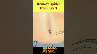 Remove spider from navel | asmr maggot removal animation | 구더기 제거