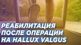 HALLUX VALGUS: СРОКИ РЕАБИЛИТАЦИИ ПОСЛЕ ОПЕРАЦИИ. ОШИБКИ ПАЦИЕНТОВ. ДОКТОР ИГОРЬ ПАХОМОВ.