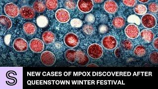 New cases of MPox discovered after Queenstown Pride Festival | Stuff.co.nz