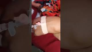 cannulation.. long video.. part 79 #cannula