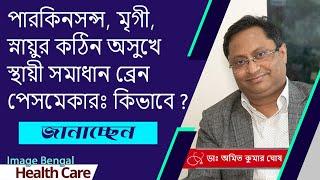 Cured Permanently Epilepsy and Parkinson's Disease |Brain pacemaker |Neurosurgeon | Dr.Amit Ghosh |