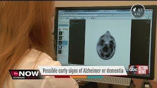 New research reveals early signs of dementia and Alzheimer's