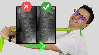 Best Exercise to Fix Loss of Neck Curve (cervical lordosis) or Military Neck | Dr. Jon Saunders