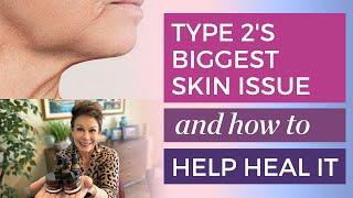 Type 2: How to Treat Jowls Without Surgery | Carol Tuttle