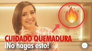  QUEMADURA Consejos de una DERMATOLOGA @drapilarochoa - Dermatologa