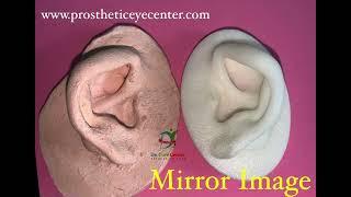 Silicone Artificial Ear | Microtia | Auricular Prosthesis.