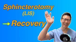 LIS fissure surgery: How long is the recovery?