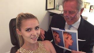 Rhinoplasty and Chin Implant Transformation by Dr. Barry Weintraub in NYC