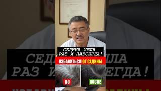 ЧУДО СРЕДСТВО ОТ СЕДИНЫ! СЕДИНА УШЛА РАЗ И НАВСЕГДА!