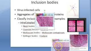 Microbiology 447 a Inclusion Bodies Virus negri bodies classify guarnieri vaccinia molluscum