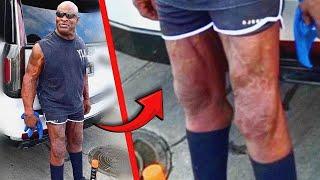 ¡¿ WTF HAPPENED TO RONNIE COLEMAN'S LEGS!?