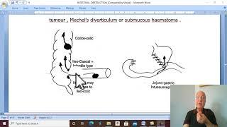 Intestinal disorders in Arabic 7 ( Intussusception , part 1 ) , by Dr. Wahdan