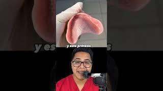 Prótesis de boca económicas #dientes #dentista #tips #parati #viral #fyp #shorts #shortvideo #fypシ