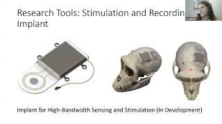 Jessi Mischel, Ripple, "Pushing the Limits of Neurotechnology": Neuroprosthetics