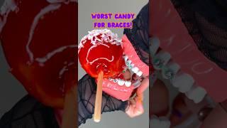 CANDY / FOODS YOU CAN'T EAT WITH BRACES ON HALLOWEEN EDITION ORTHODONTIST REACTS CRUNCHY FOOD ASMR